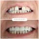 Slider image (9) Adaport Dental Clinic